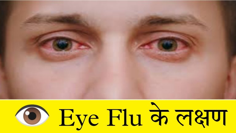 Eye Flu 👁️ के लक्षण